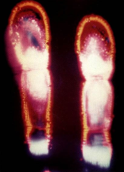 Kirlian photograph of two fingers